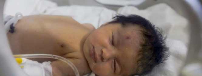 Bebé que nasceu nos escombros na Síria alvo de três tentativas de rapto